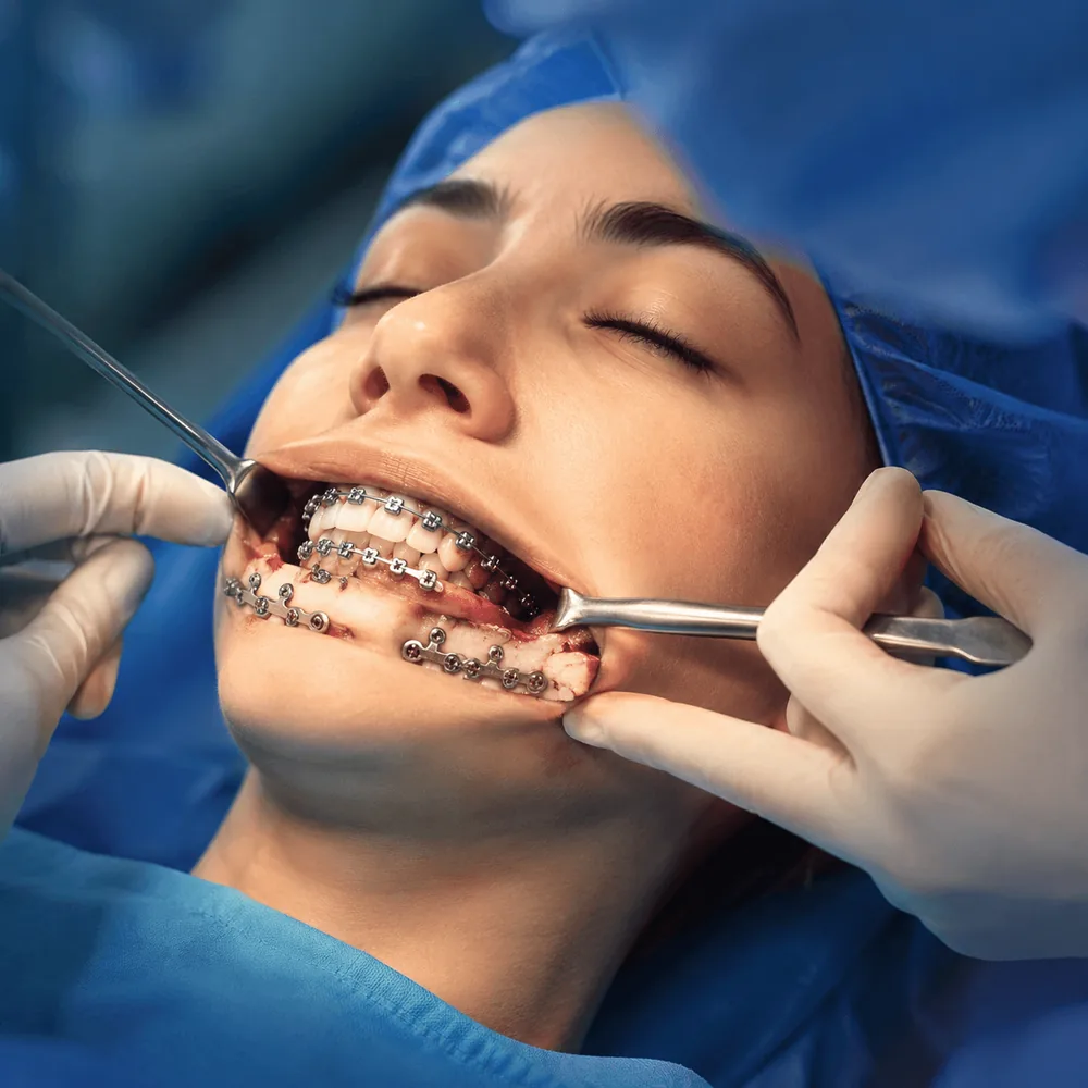 Cirurgia Ortognática
